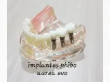 Clinica Dental Liria Aragón