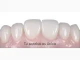 Clínica Dental Mibo Almería