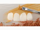 Clínica Dental Montagut Almeria