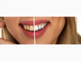 Clínica Dental Om. Dra. Elizabeth Romano