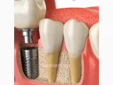 Clinica Dental Ortodentist