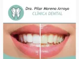 Clinica Dental Pilar Moreno Arroyo