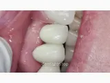 Clinícas Dentalia