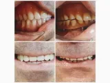Dental Horta