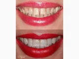 Ilc Dental