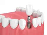 Massi Clínica Dental