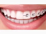 Serrano Dental 🦷